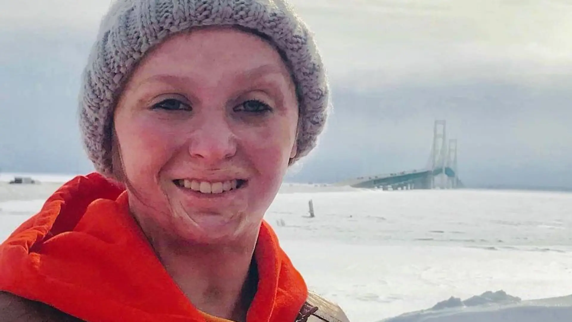 Als die heute 21-jährige Charity Sutter aus Flint im US-Bundesstaat Michigan vier Jahre alt ist, übergießt Charitys Mutter ihren Kopf mit Benzin, um hartnäckige Kopfläuse abzutöten.