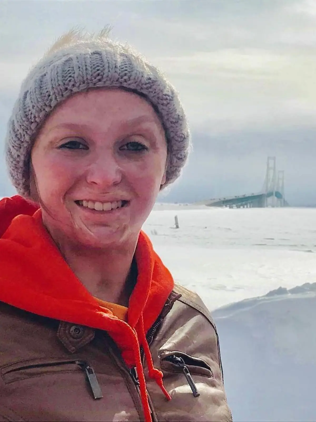 Als die heute 21-jährige Charity Sutter aus Flint im US-Bundesstaat Michigan vier Jahre alt ist, übergießt Charitys Mutter ihren Kopf mit Benzin, um hartnäckige Kopfläuse abzutöten.