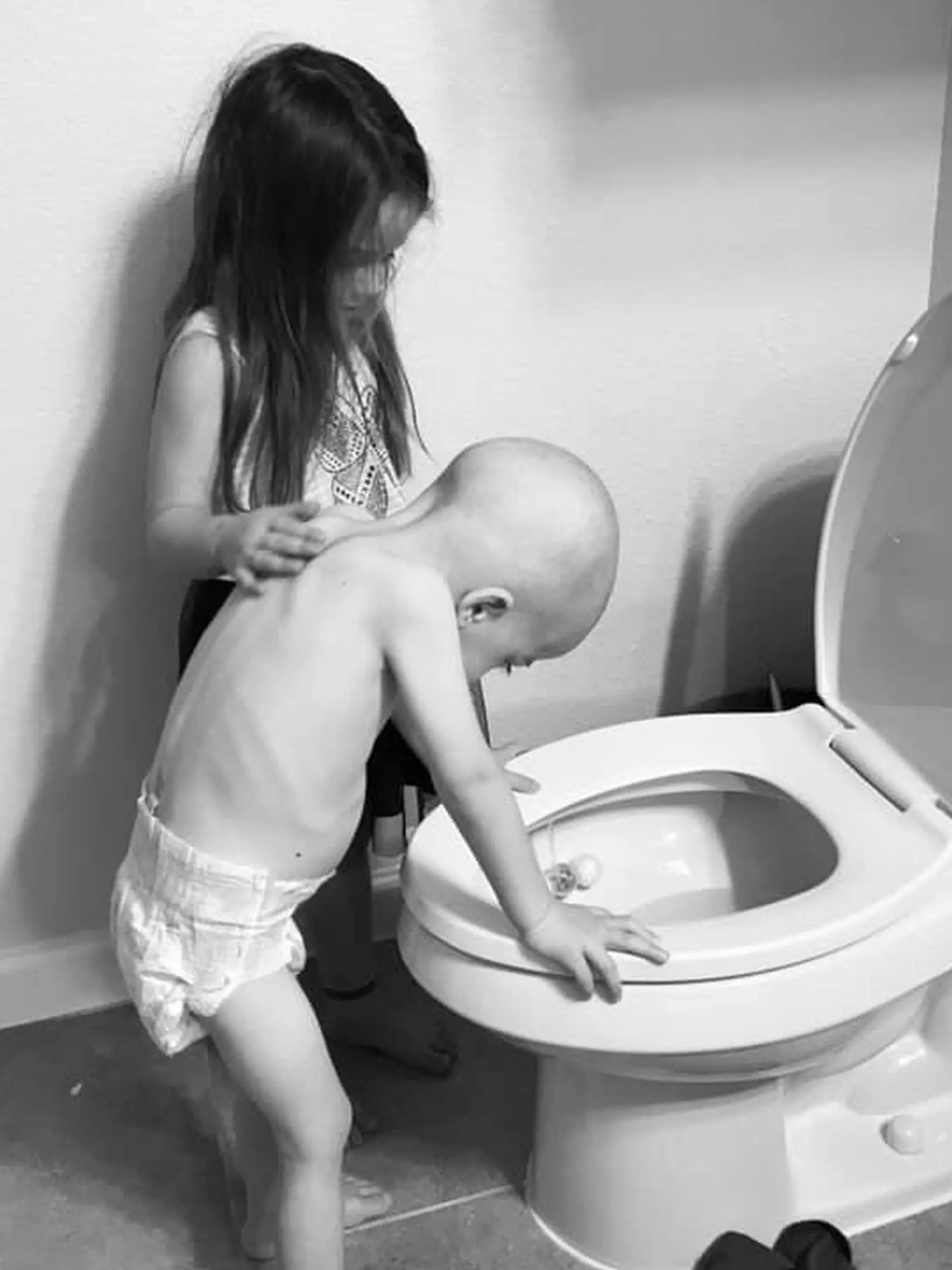 Der vierjährige Beckett Burge wird von seiner Schwester Aubrey (5) gepflegt.