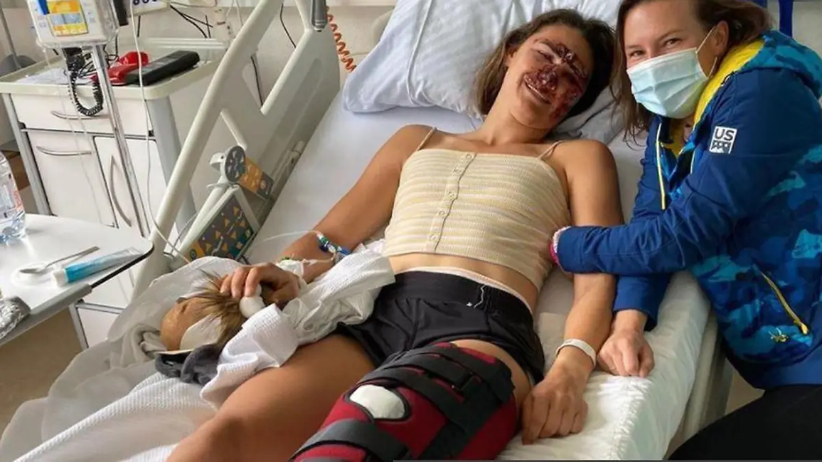 Alice Merryweather verletzte sich bei einem Trainingssturz schwer - vor allem am linken Bein