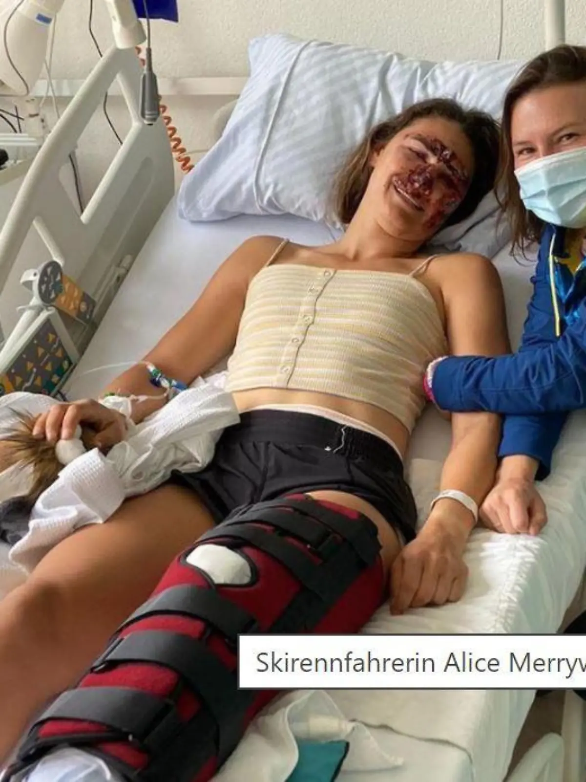 Alice Merryweather verletzte sich bei einem Trainingssturz schwer - vor allem am linken Bein