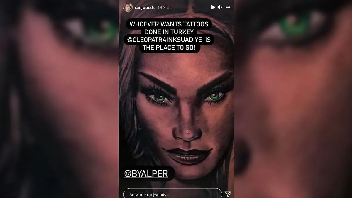 Carl Woods hat sich das Gesicht von Katie Price tätowrieren lassen.