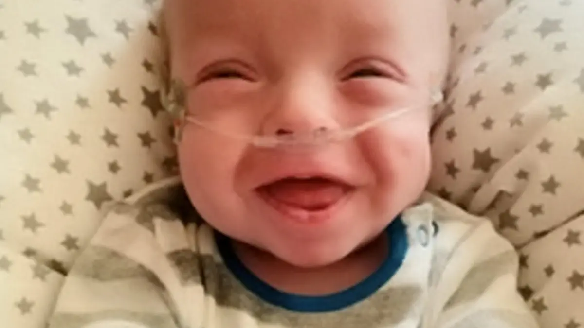 SONDERKONDITIONEN: Satzpreis!
Chester now. See SWNS story SWBRbaby; A mum was urged to terminate her pregnancy when her waters broke at just 20 weeks and she was told her baby had less than one per cent of survival - but now he is thriving. Little Chester Rice, now nine months old, was born weighing just 834g, or 1lb 8oz - less than a bag of sugar - a whole ten weeks after mum Ann's waters broke at just 20 weeks. Mum-of-three Ann, 36, from Cardiff, Wales, was told she would miscarry naturally within 48 hours, and was sent home from hospital with antibiotics. And when she didn't miscarry, she was advised by multiple doctors to terminate her pregnancy, due to the risk of her contracting sepsis. Ann, who is also mum to Connor, seven, and 19-month-old Riley, said receiving the news was "horrific" - but she and husband Chris, 38, took the decision to continue the pregnany.