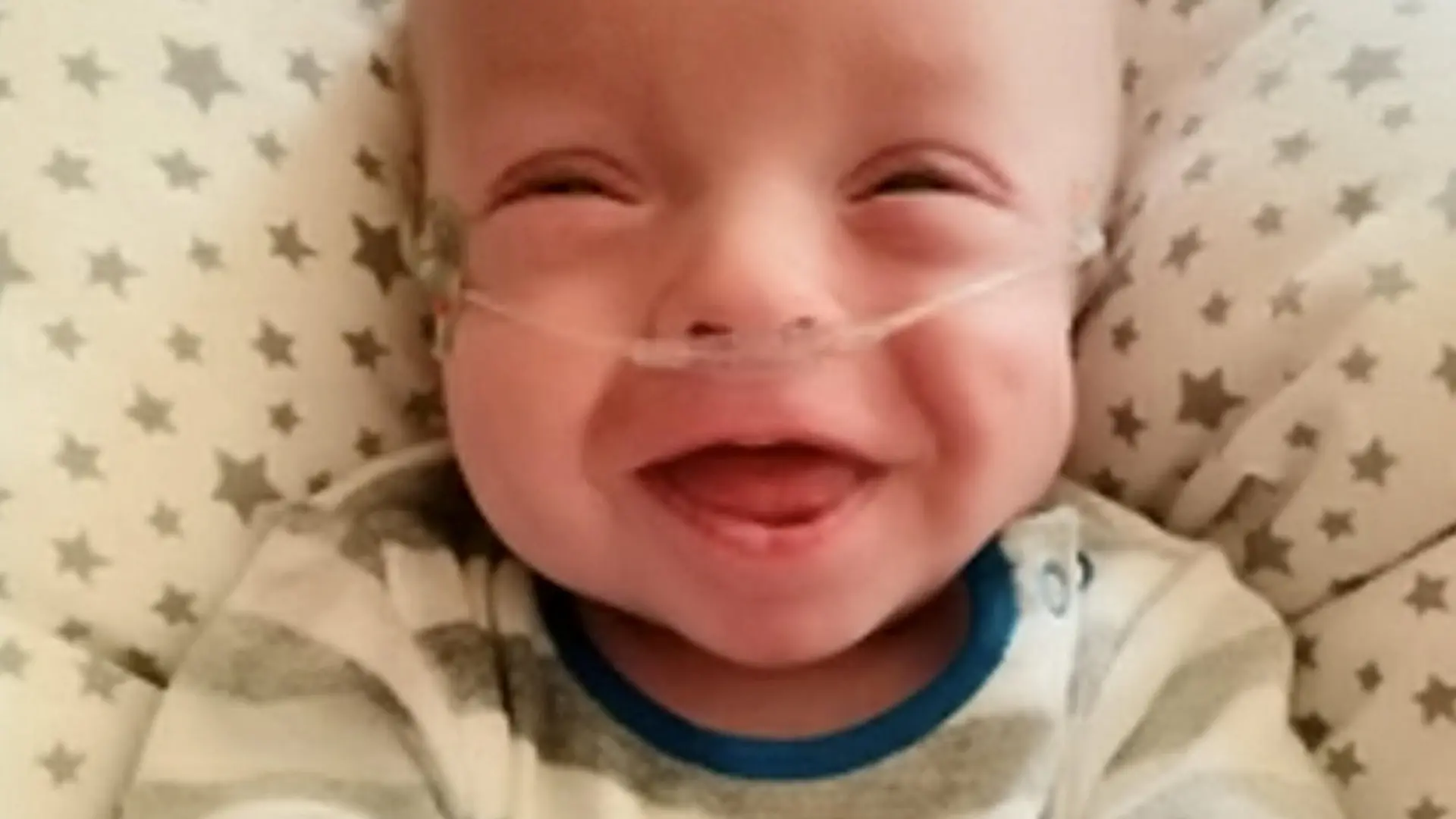 SONDERKONDITIONEN: Satzpreis!
Chester now. See SWNS story SWBRbaby; A mum was urged to terminate her pregnancy when her waters broke at just 20 weeks and she was told her baby had less than one per cent of survival - but now he is thriving. Little Chester Rice, now nine months old, was born weighing just 834g, or 1lb 8oz - less than a bag of sugar - a whole ten weeks after mum Ann's waters broke at just 20 weeks. Mum-of-three Ann, 36, from Cardiff, Wales, was told she would miscarry naturally within 48 hours, and was sent home from hospital with antibiotics. And when she didn't miscarry, she was advised by multiple doctors to terminate her pregnancy, due to the risk of her contracting sepsis. Ann, who is also mum to Connor, seven, and 19-month-old Riley, said receiving the news was "horrific" - but she and husband Chris, 38, took the decision to continue the pregnany.