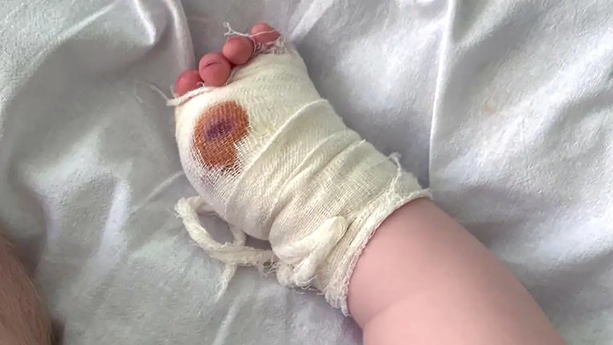 Anastasia G's 14-month-old son Leon lost his left thumb in a Safari park tiger attack in Crimea; pictured at hospital 