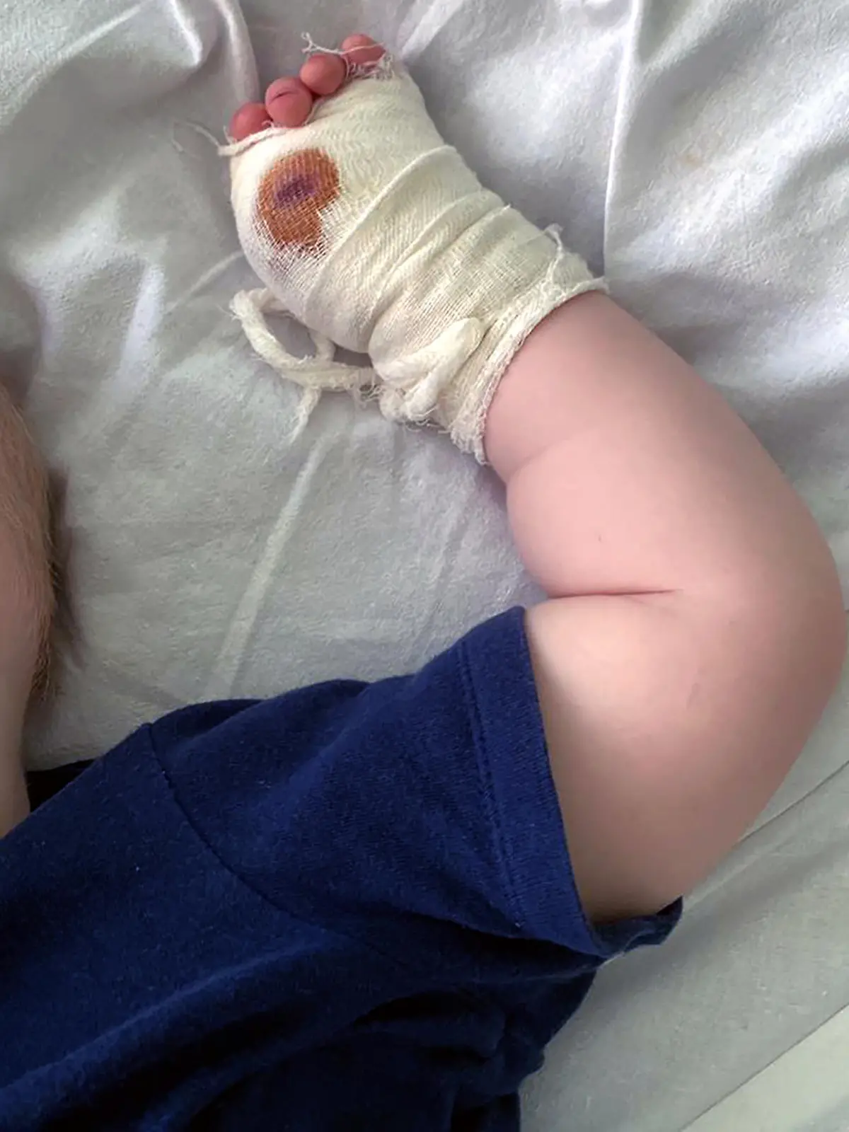 Anastasia G's 14-month-old son Leon lost his left thumb in a Safari park tiger attack in Crimea; pictured at hospital 