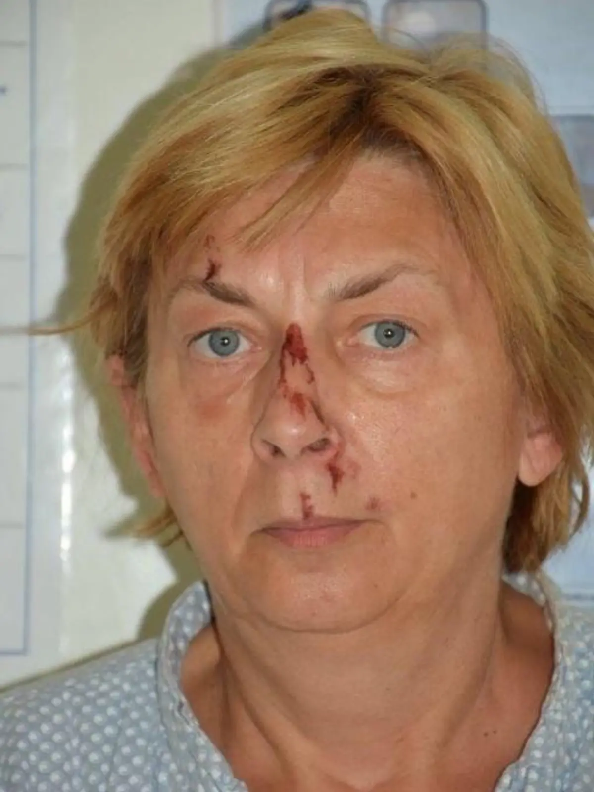 Diese Fotos hat die Polizei von Krk veröffentlicht, um das Rätsel um die Identität der Frau ohne Gedächtnis zu lösen.
