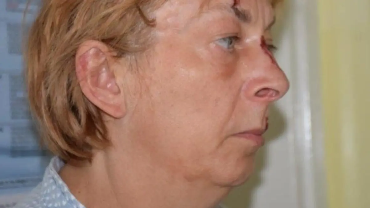 Diese Fotos hat die Polizei von Krk veröffentlicht, um das Rätsel um die Identität der Frau ohne Gedächtnis zu lösen.