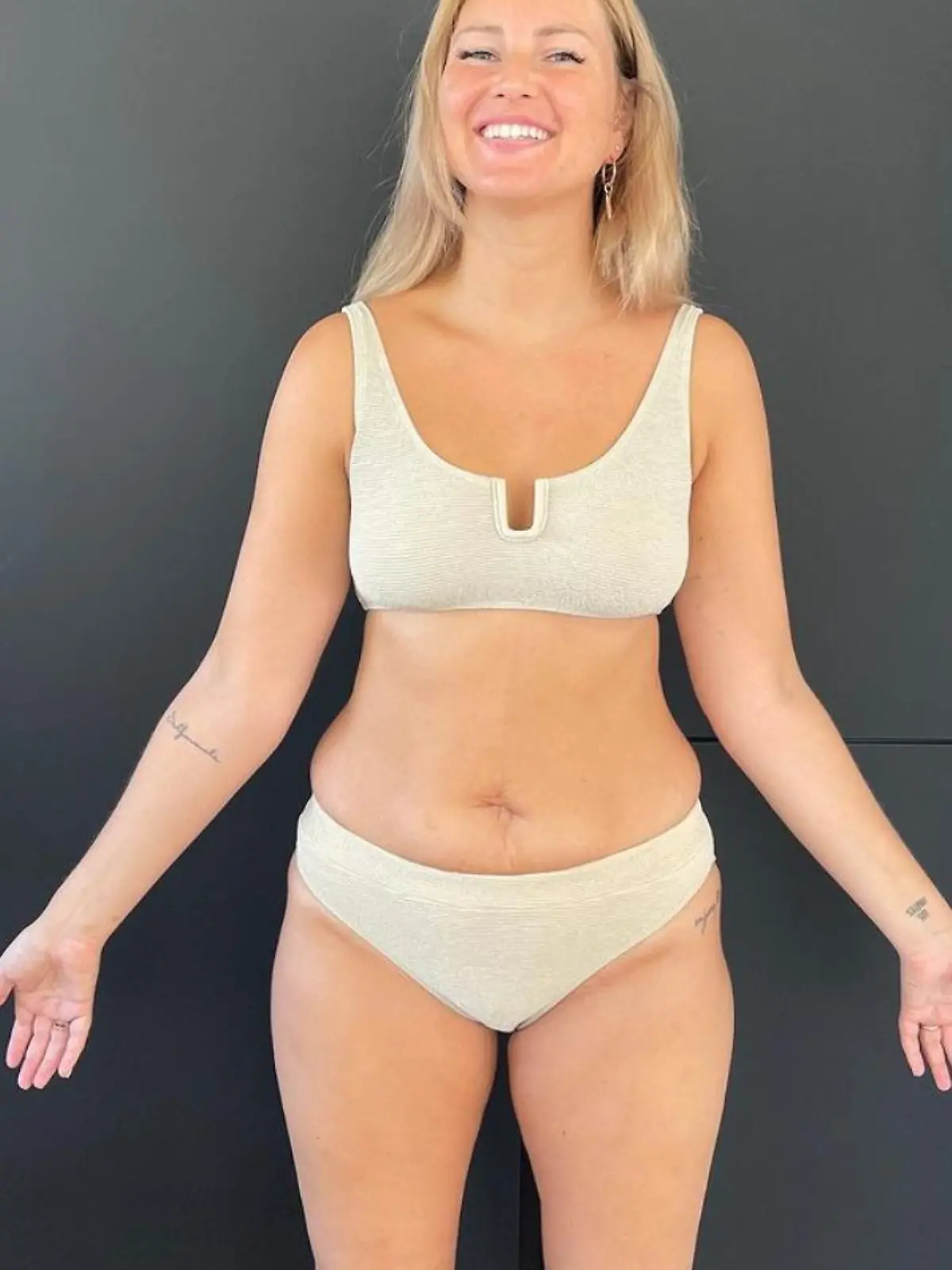 Maren Wolf zeigt ein Jahr nach der Geburt ihres Sohnes ihren After-Baby-Body.