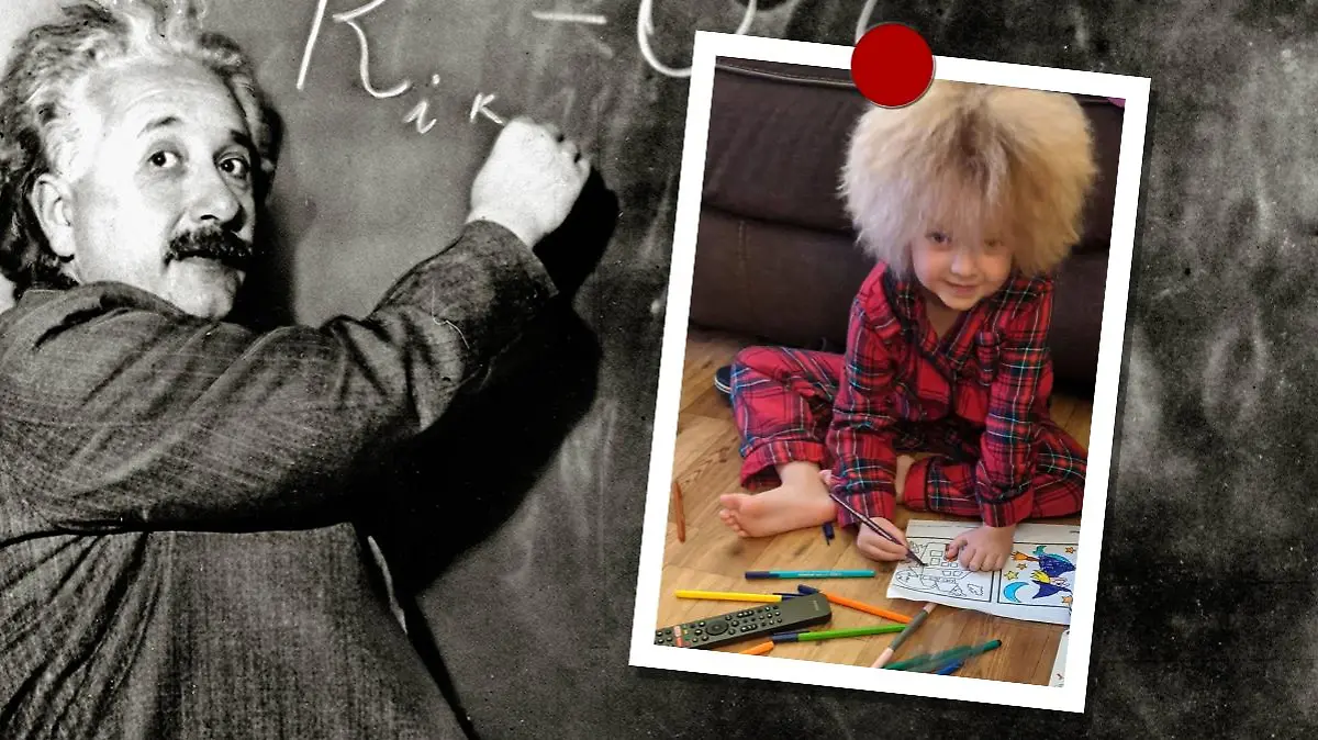 Albert Einstein litt an der gleichen Krankheit wie die kleine Florence.