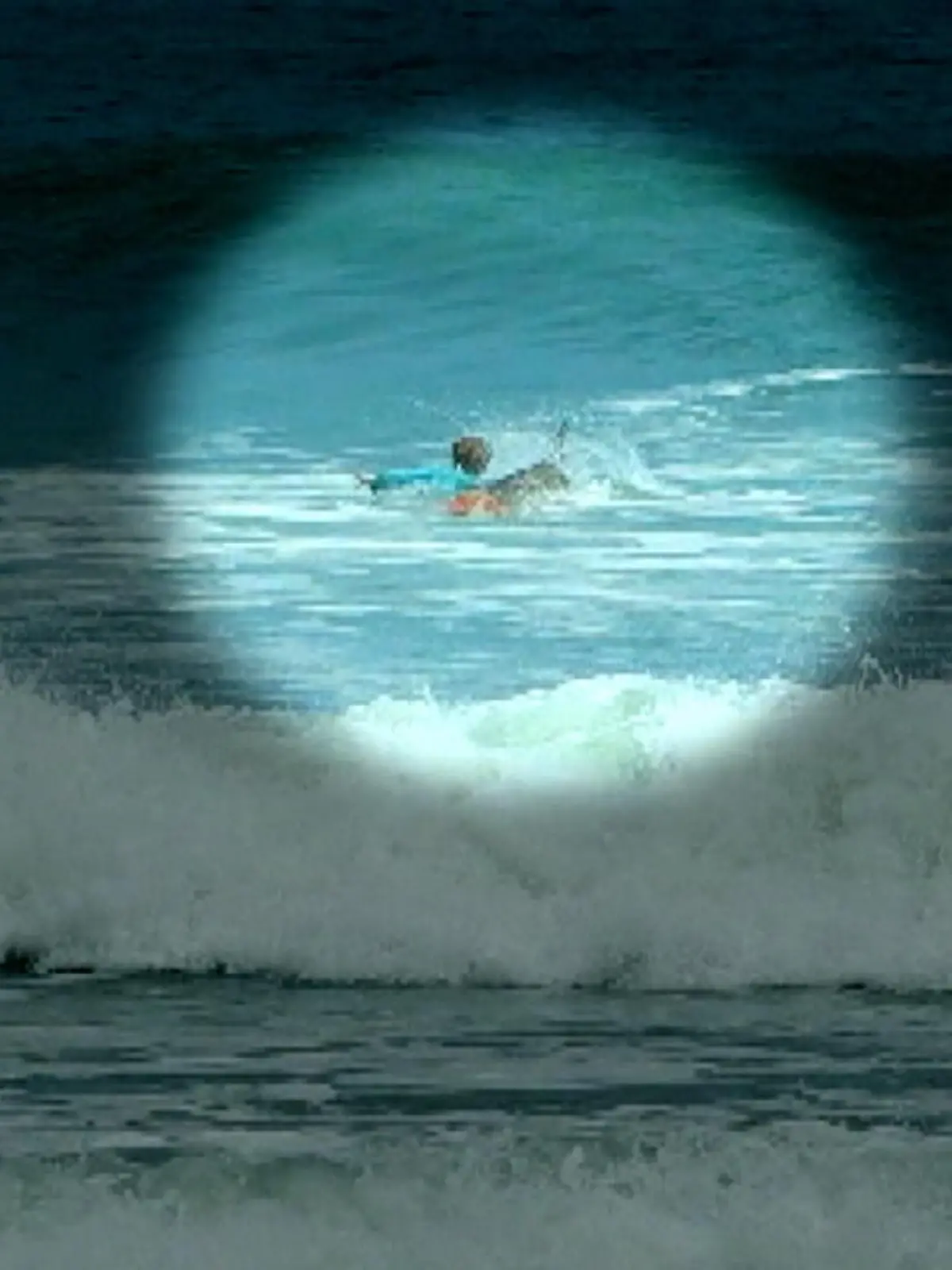 Bild zu: "Surfer (16) von Hai in Arm gebissen"