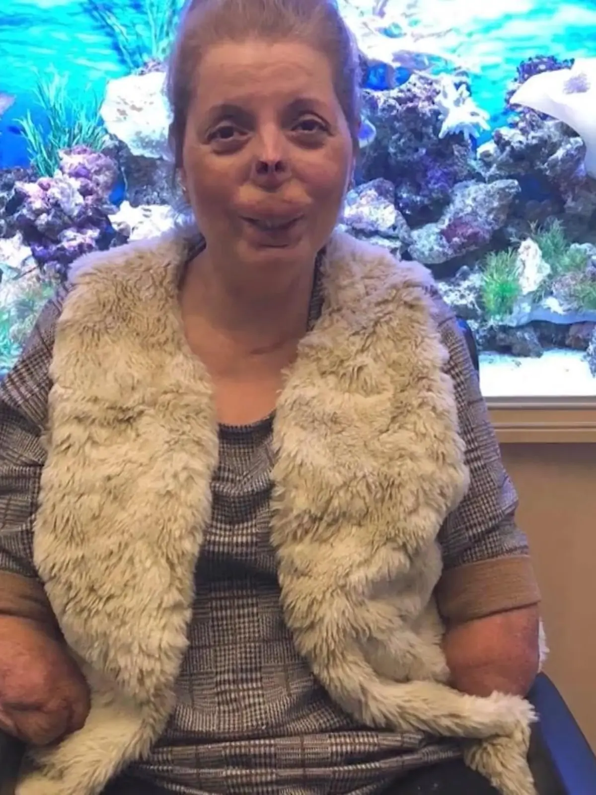 Sue Neill, aus Chichester in England, hat mittlerweile sowohl ihre beiden Arme als auch ihre beiden Bene verloren. Der Grund: Ein zunächst harmlos erscheinender Abzess auf dem Zahnfleisch, mit dem die 52-Jährige sich 2017 zum Zahnarzt begeben musste. Es folgte eine Blutvergiftung – und was dann geschah, sollte das Leben der Britin für immer verändern. Wie Sie es trotzdem geschafft hat, ihren Alltag zu meistern, sehen Sie im Video.