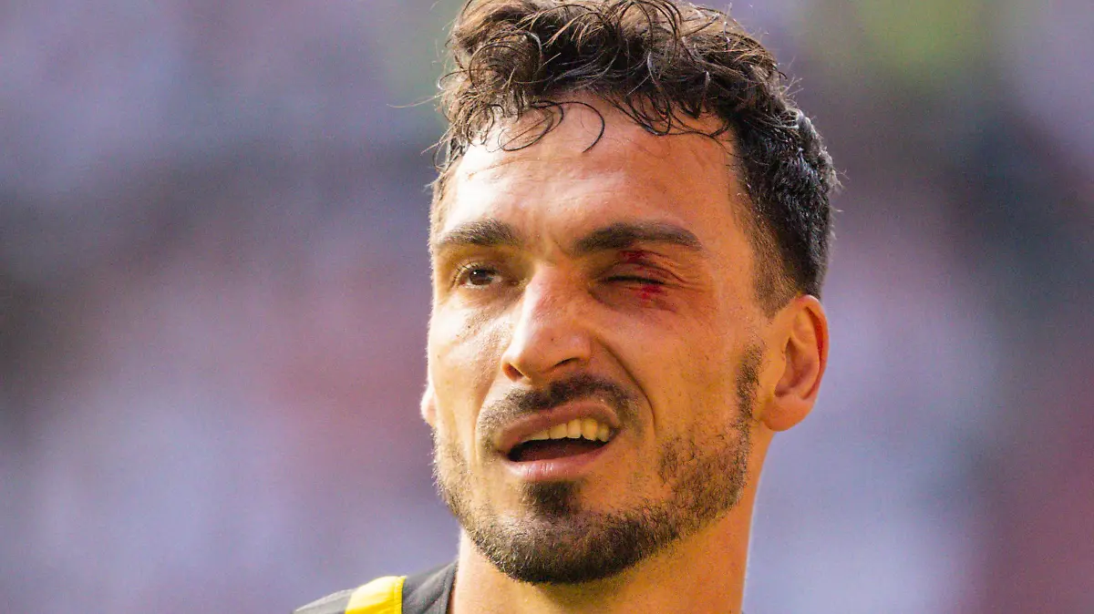 Augsburg, Germany. 21th Mai, 2023. Mats Hummels BVB mit blauem Auge FC Augsburg - Borussia Dortmund 21.05.2023 *** Augsburg, Germany May 21, 2023 Mats Hummels BVB with a black eye FC Augsburg Borussia Dortmund 21 05 2023