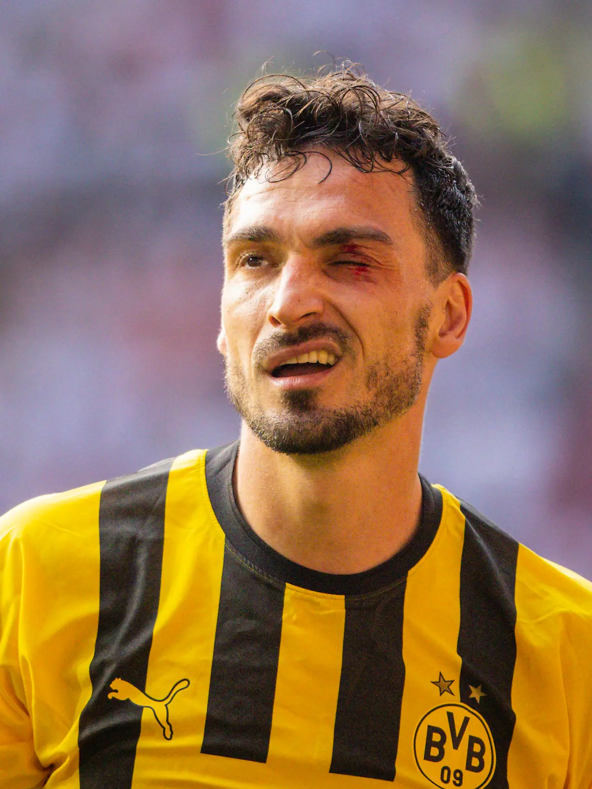 Augsburg, Germany. 21th Mai, 2023. Mats Hummels BVB mit blauem Auge FC Augsburg - Borussia Dortmund 21.05.2023 *** Augsburg, Germany May 21, 2023 Mats Hummels BVB with a black eye FC Augsburg Borussia Dortmund 21 05 2023