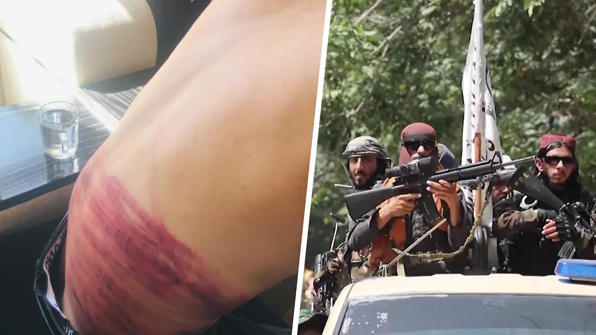Kabul: Taliban schlagen Journalisten – mit Kabeln und Peitschen