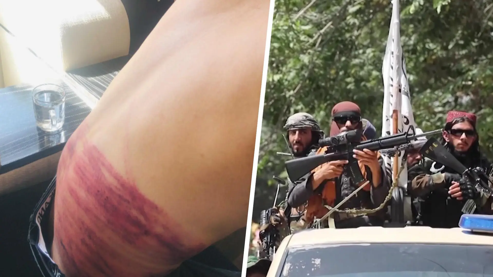Kabul: Taliban schlagen Journalisten – mit Kabeln und Peitschen