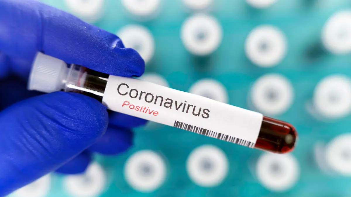 Laborarzt hält ein Reagenzglas mit positivem Ergebnis des Coronavirus-Tests in der Hand, im Hintergrund viele Blutröhrchen, Deutschland, Europa *** Laboratory physician holds a test tube with a positive result of the coronavirus test in his hand, in the background many blood tubes, Germany, Europe Copyright: imageBROKER/EunikaxSopotnicka ibxeso05141468.jpg Bitte beachten Sie die gesetzlichen Bestimmungen des deutschen Urheberrechtes hinsichtlich der Namensnennung des Fotografen im direkten Umfeld der Veröffentlichung!