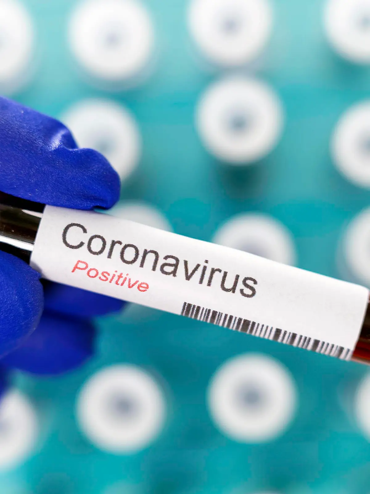  Laborarzt hält ein Reagenzglas mit positivem Ergebnis des Coronavirus-Tests in der Hand, im Hintergrund viele Blutröhrchen, Deutschland, Europa *** Laboratory physician holds a test tube with a positive result of the coronavirus test in his hand, in the background many blood tubes, Germany, Europe Copyright: imageBROKER/EunikaxSopotnicka ibxeso05141468.jpg Bitte beachten Sie die gesetzlichen Bestimmungen des deutschen Urheberrechtes hinsichtlich der Namensnennung des Fotografen im direkten Umfeld der Veröffentlichung!