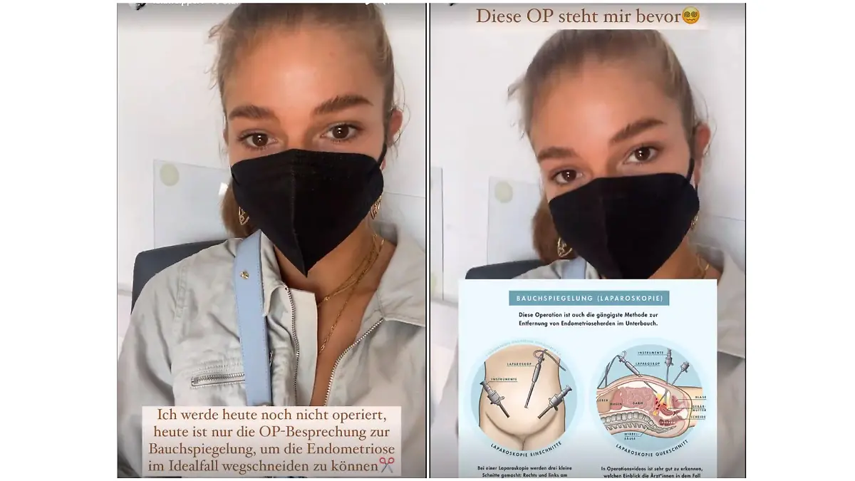 Lola Weippert spricht offen über ihre Endometriose