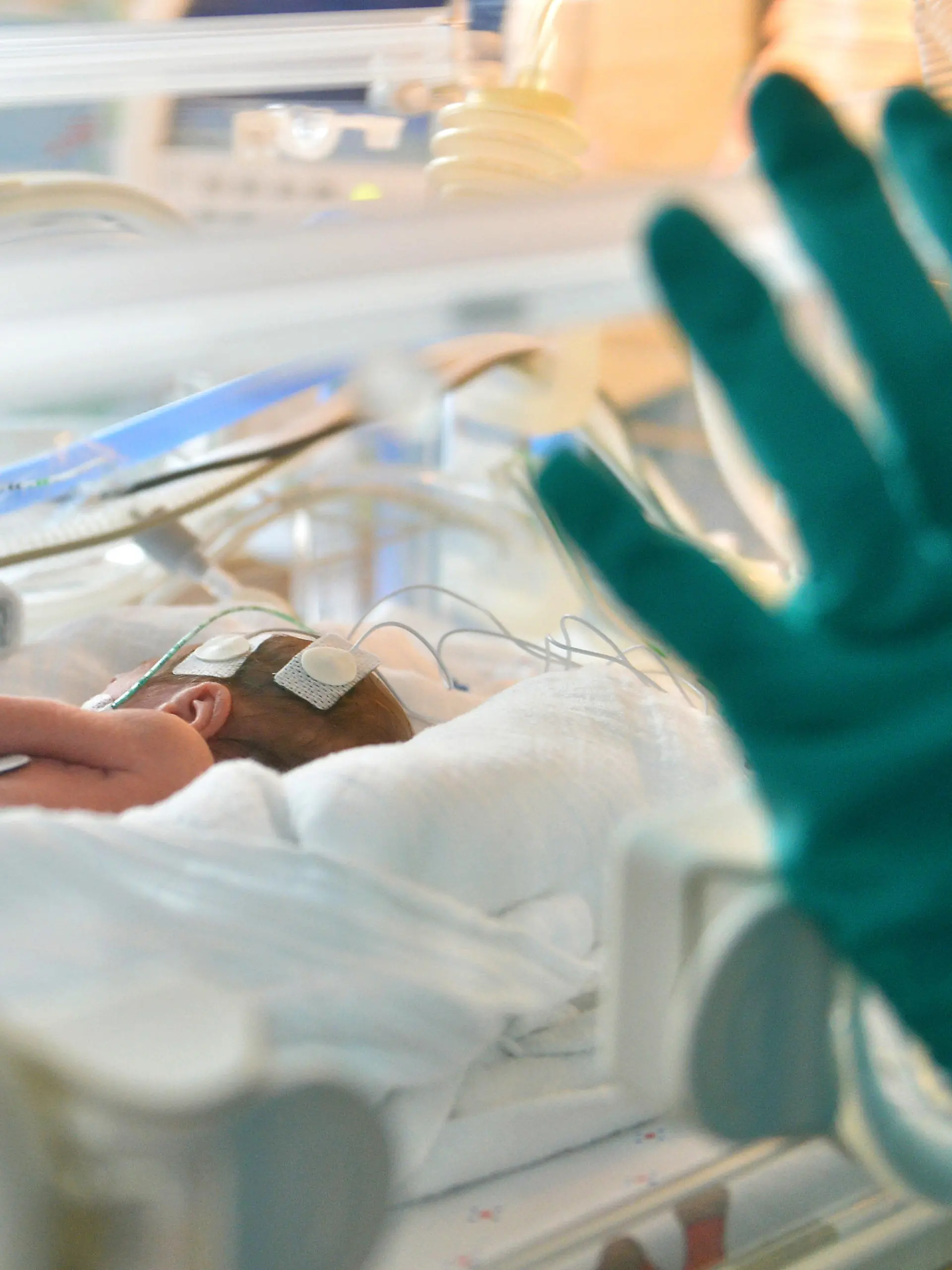 ARCHIV - 05.02.2013, Berlin: Ein zu früh geborenes Baby liegt  in der Neonatologie in einem Inkubator. Im Prozess gegen eine frühere Krankenschwester, die mehreren Frühchen unerlaubt Medikamente verabreicht haben soll, wird vor dem Landgericht in Marburg am Donnerstag (28.11.2019) das Urteil erwartet. Foto: Britta Pedersen/zb/dpa +++ dpa-Bildfunk +++