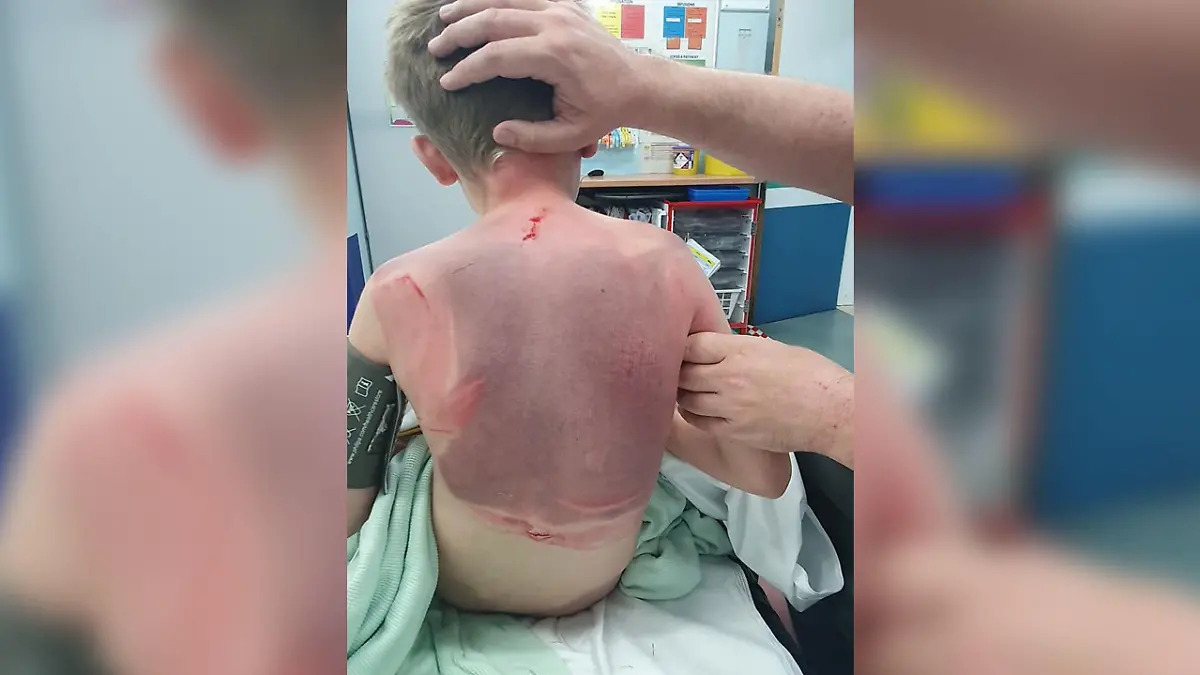 Alex Williams zeigt die schweren Verletzungen seines Sohnes auf Facebook.