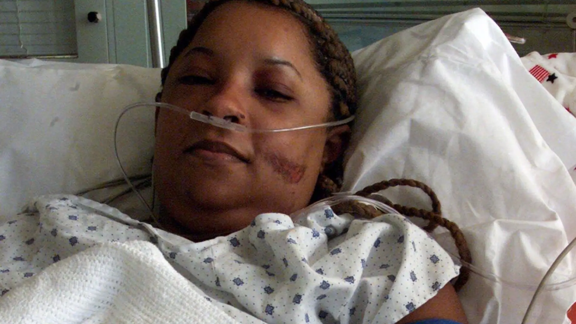Ginelle Guzman, 32, of Brooklyn, N.Y., recuperates from Tuesday's terrorist attack on the World Trade Center, in Bellevue Hospital Center in New York, Friday, Sept. 14, 2001. Guzman was on the 64th floor when the attack occurred. She made it to the 13th floor before building collapsed and was rescued Wednesday. (AP Photo/Paul Chiasson, Pool)