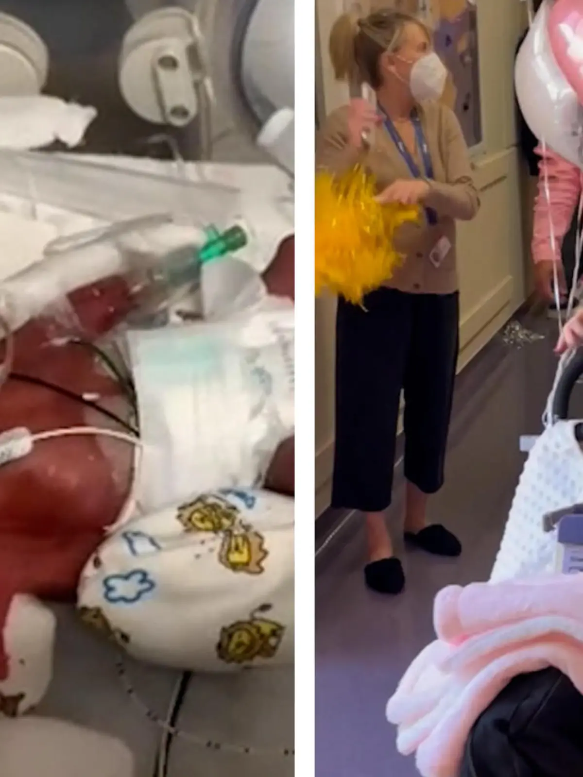 Es sind schwere Monate, die Baby Sloane bereits hinter sich hat. Im Mai 2022 kommt sie drei Monate zu früh auf die Welt, wiegt damals nur 680 Gramm; etwa so viel wie drei Fleischtomaten. Und nicht nur das: Sloane ist schwer krank. Sie hat eine seltene Genmutation, die ihr Herz und ihre Lunge angreift. Nur Dank viel Glück und jeder Menge Operationen überlebt Sloane - und kann nun, fast ein Jahr später, endlich nach Hause gehen.
