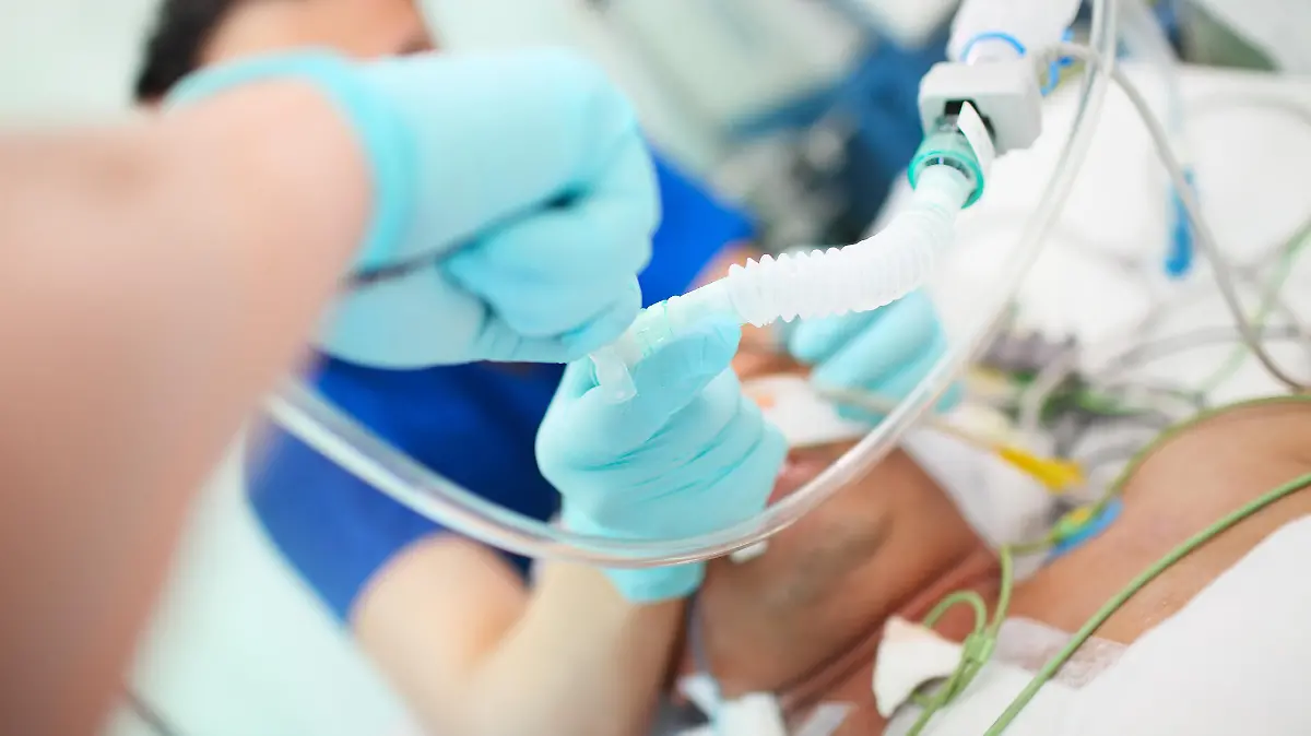 Medical doctor with assistant intubates male patient in the critical care unit.