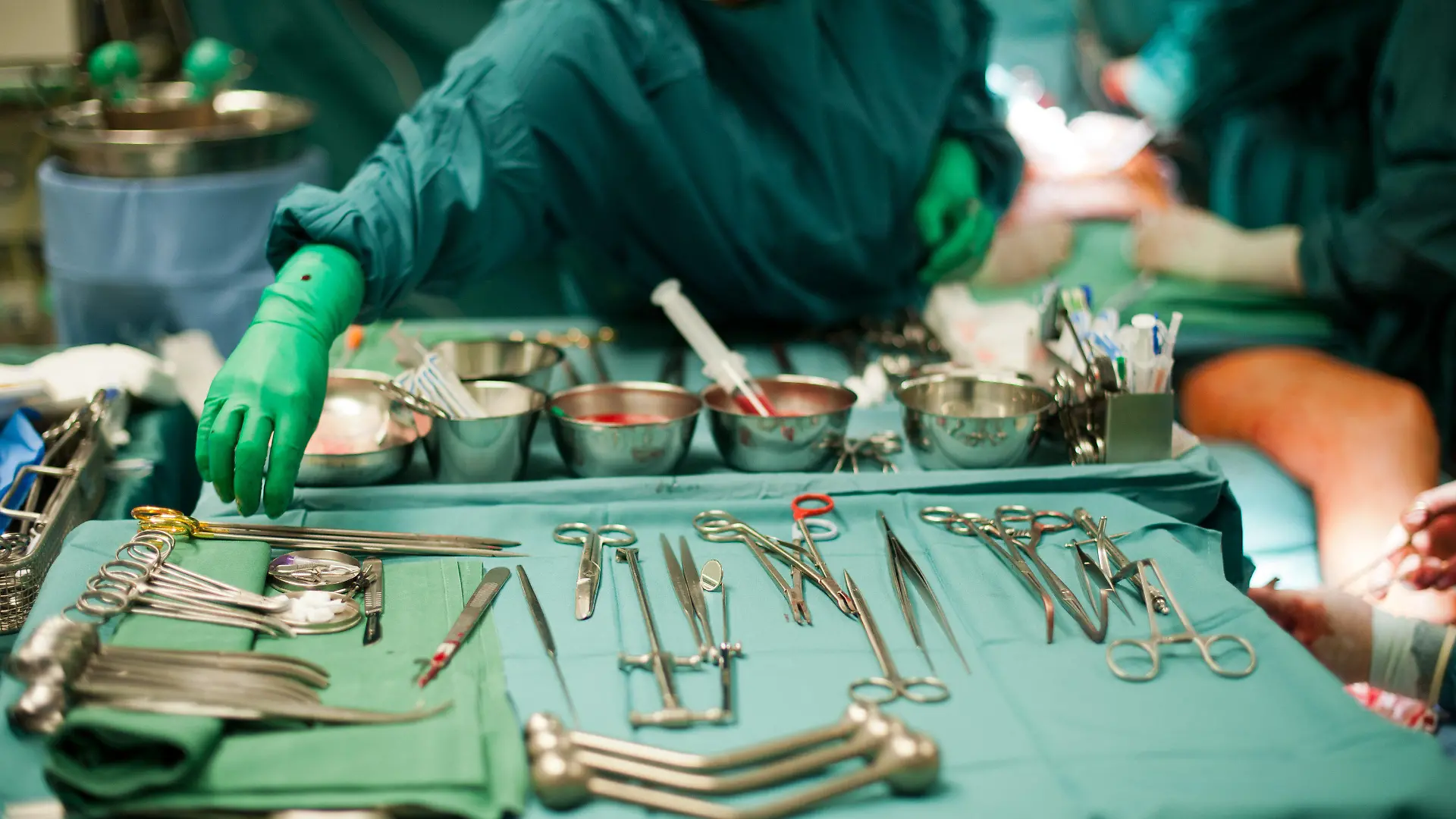 ARCHIV - Ein Operationsteam in einem Krankenhaus operiert am 12.07.2012 Patienten am offenen Herzen. Mandeln werden Studien zufolge in manchen Regionen Deutschlands achtmal häufiger operiert als anderswo. Ähnlich große regionale Unterschiede gebe es bei Blinddarm- oder Prostata-Operationen. Foto: Maurizio Gambarini/dpa (zu dpa "Studien: In manchen Regionen wird bis zu achtmal mehr operiert" vom 11.09.2014) +++(c) dpa - Bildfunk+++
