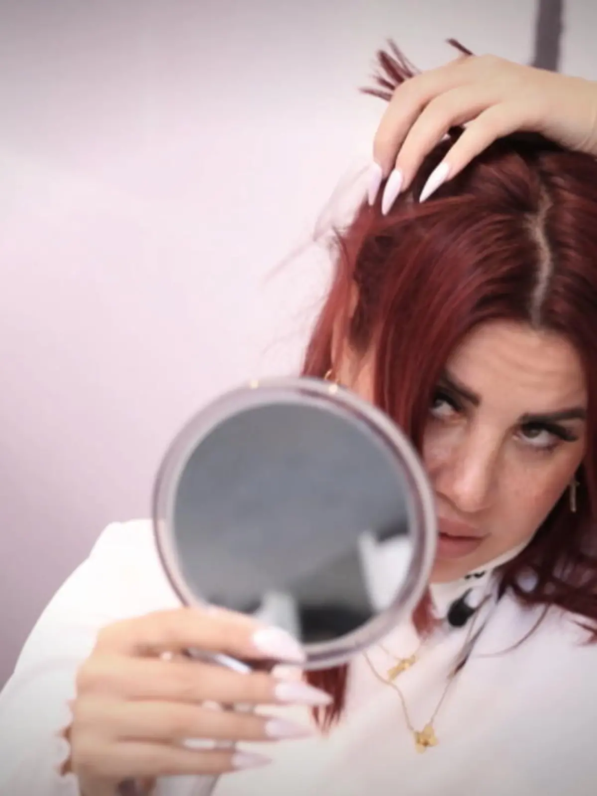Kate Merlan leidet an Haarausfall.