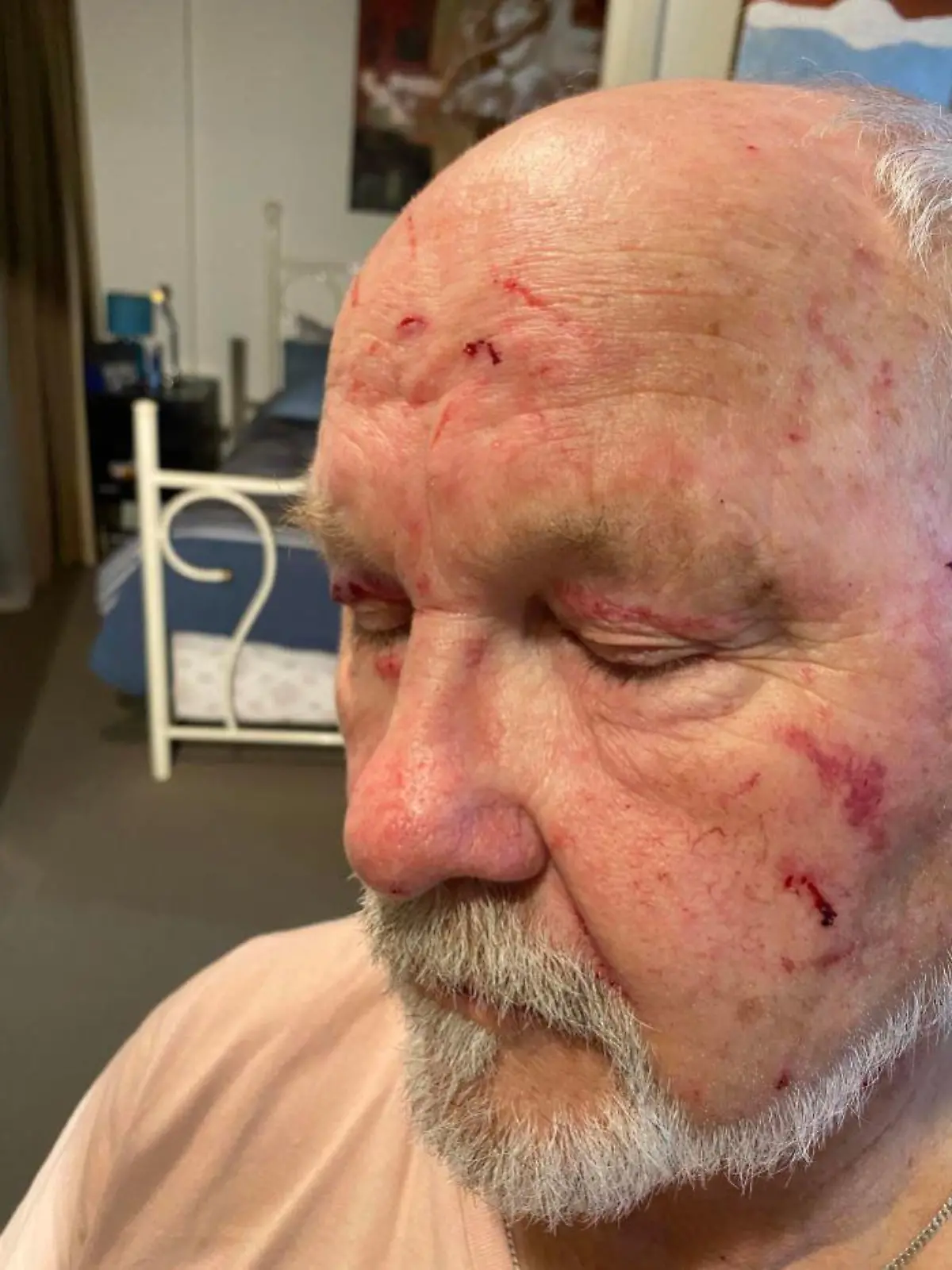 Busfahrer will Streit beenden - Mädchen versucht, ihm das Auge auszukratzen