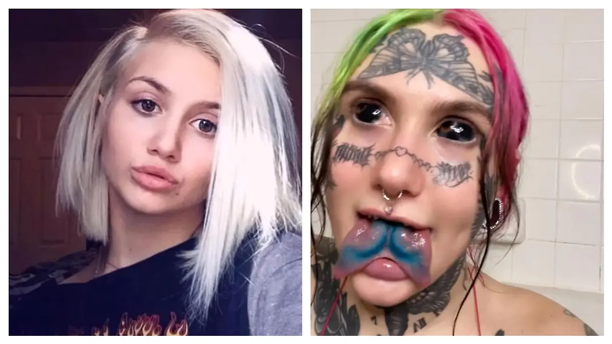 Vorher-nachher-Foto Kierstyn Milligan