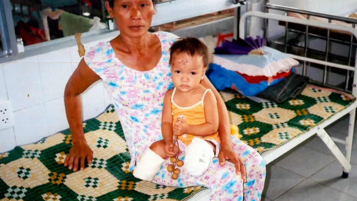 This 2004 photo shows Haven Shepherd sitting on her grandmother's lap in a hospital in Vietnam. The story of how Haven Shepherd ended up in the United States is so unthinkable, it elicits gasps— sometimes an occasional, almost involuntary "Oh my God" — from the people who hear it. Unwanted by her parents, they placed her between them after they strapped bombs to themselves in an attempted family suicide. She was 14 months old. She lost both legs below the knees but survived, to later be adopted by a family in Missouri who came to Vietnam thinking they'd be bringing her home for someone else. Now on a path that could lead her to the Paralympics in 2020, the 15-year-old swimmer is as aware as anyone that the journey is every bit as important as the destination. (Shelly Shepherd via AP)