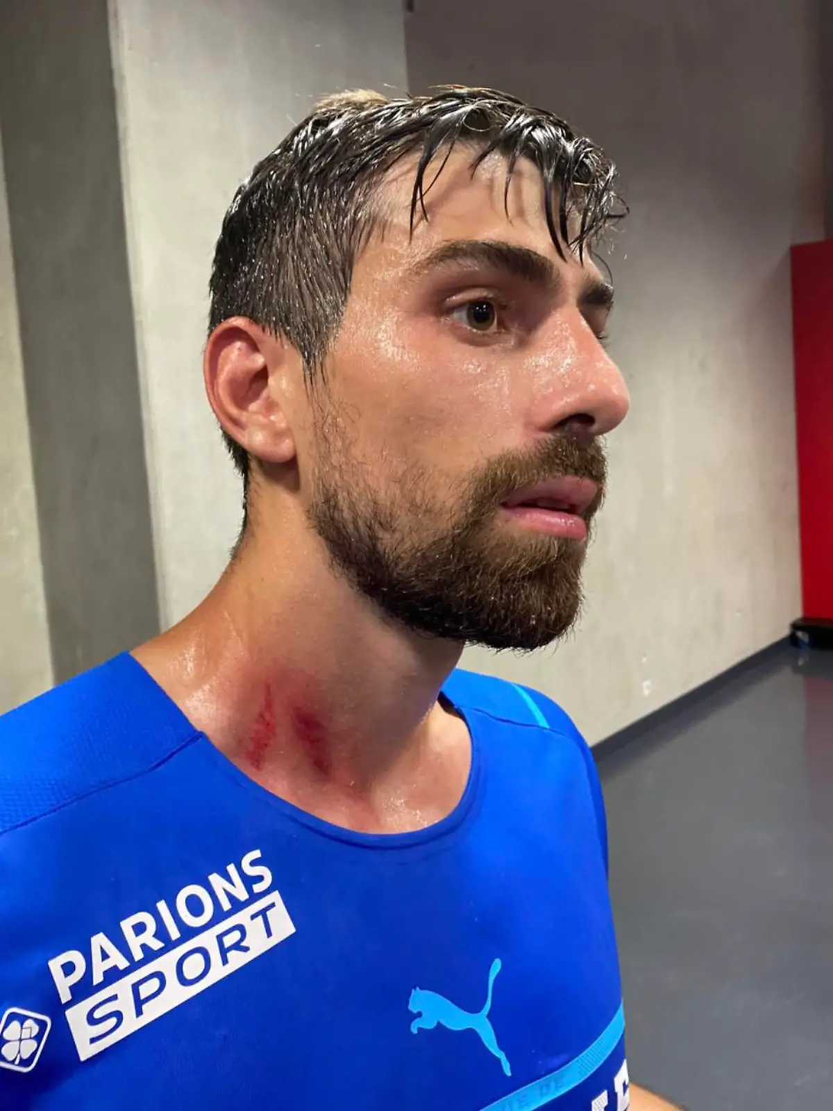 Marseille Spieler verletzt