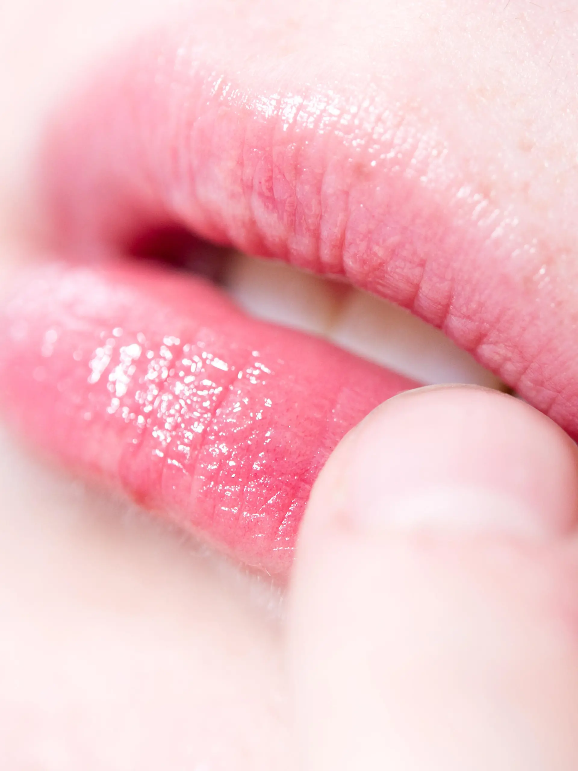 ILLUSTRATION -  Eine Frau befühlt mit einem Finger eine juckende und schmerzende Stelle auf ihrer Lippe. Foto: Franziska Gabbert
