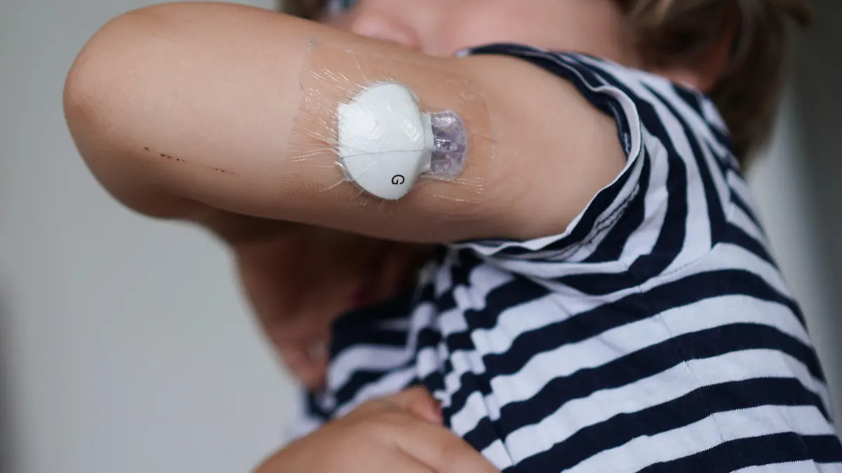 PRODUKTION - 03.08.2021, Berlin: Der vierjährige Oskar zeigt einen Sensor an seinem Arm, der seinen Blutzucker misst. In Deutschland erkranken immer mehr Kinder und Jugendliche an Diabetes mellitus Typ 1. Dass auch völlig gesunde, sportliche, aktive Kinder und Jugendliche Diabetes bekommen können, ist vielen Menschen nicht klar. (zu dpa «Plötzlich Diabetiker: Es kann schon die Jüngsten treffen») Foto: Jörg Carstensen/dpa +++ dpa-Bildfunk +++