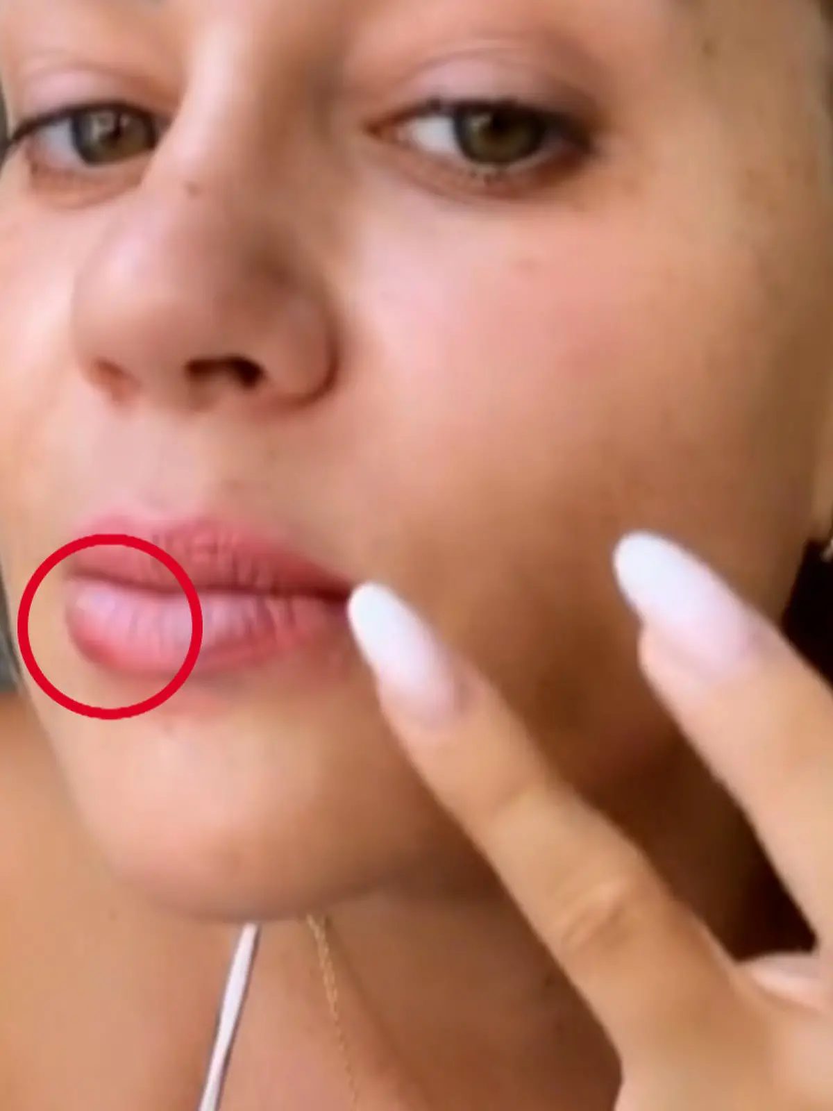 Als hätte Jessica Paszka aktuell auf Ibiza nicht schon genug Probleme, kommt nun auch noch das dazu: Die 31-Jährige hat Herpes.