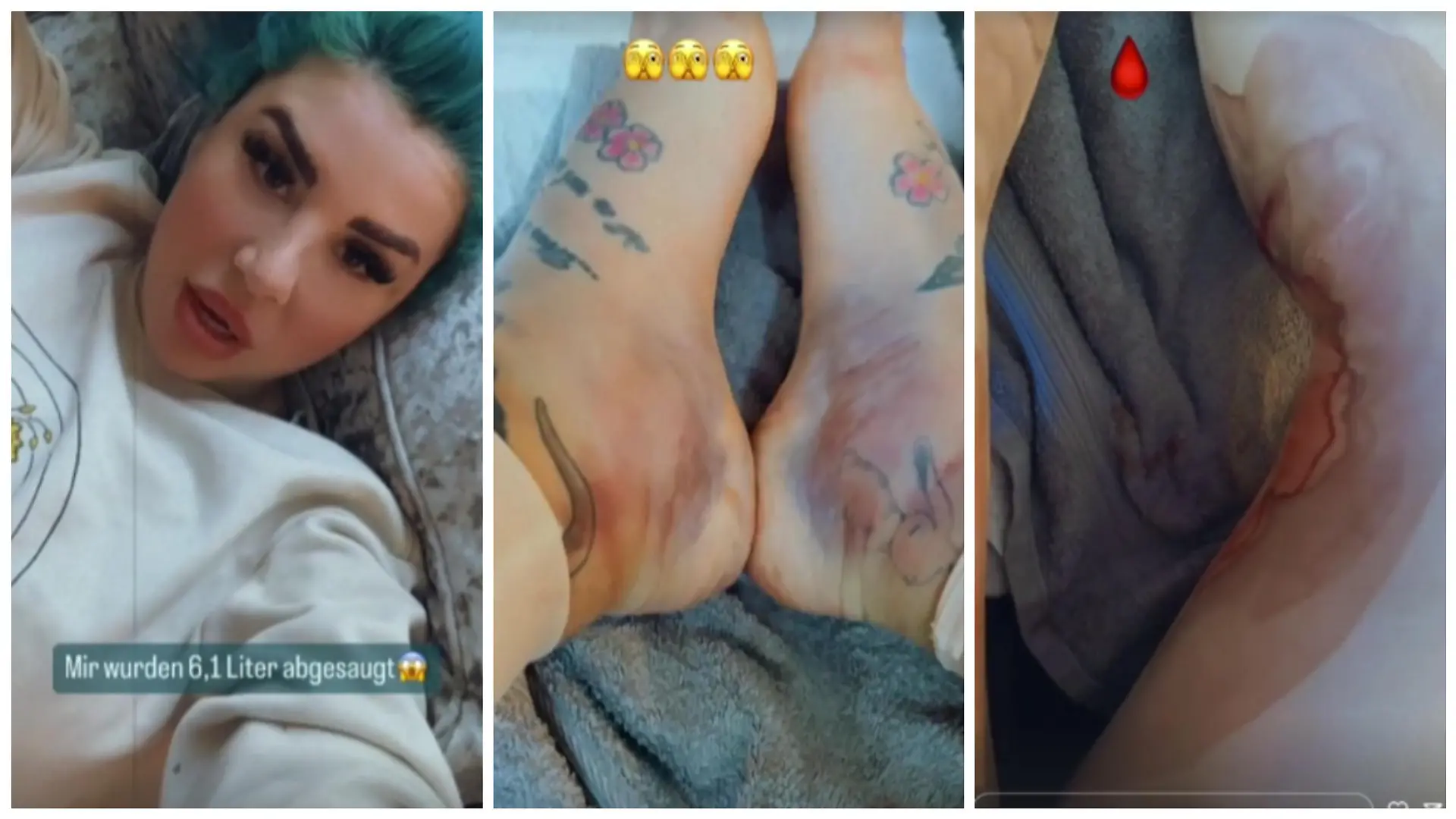 Kate Merlan nach OP