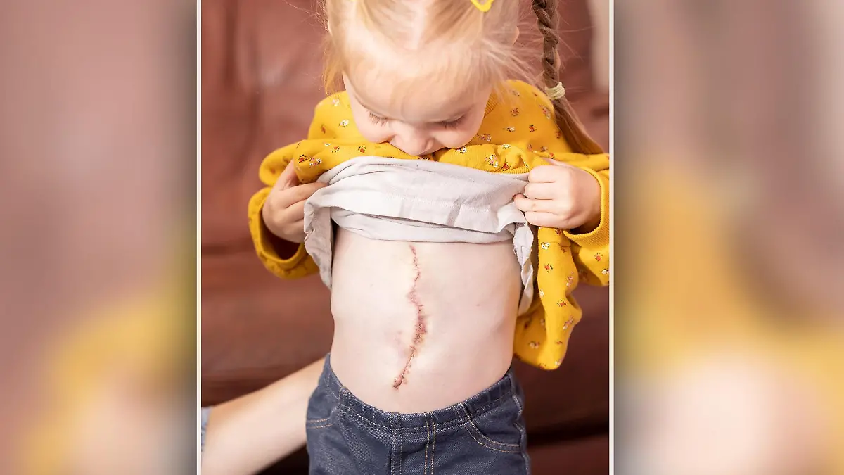 Laurel zeigt stolz ihre OP-Narbe: Jetzt beginnt für die 3-Jährige und ihre Eltern ein sorgenfreieres Leben.