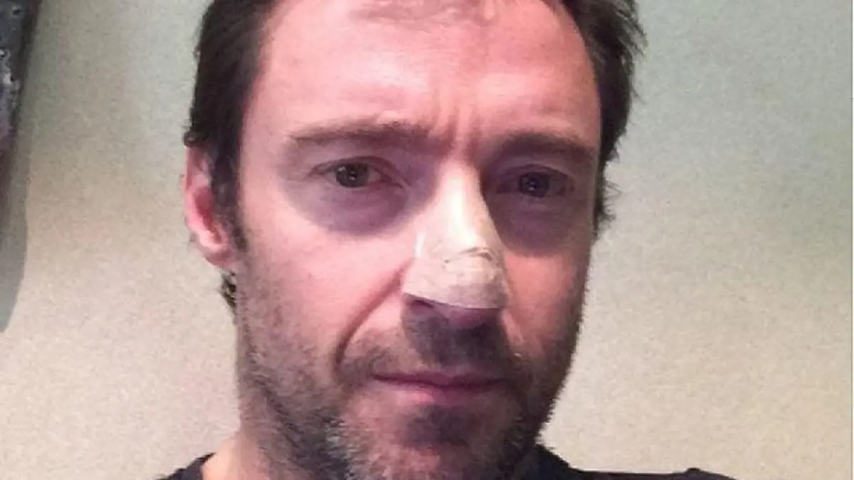 Hugh Jackman