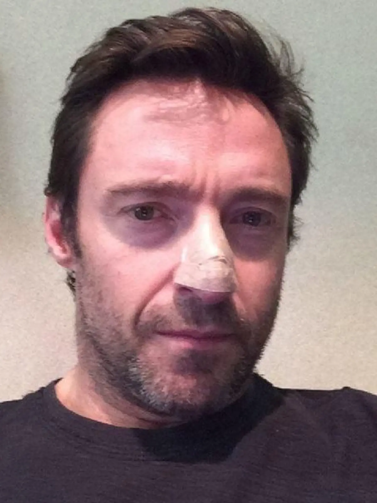 Hugh Jackman