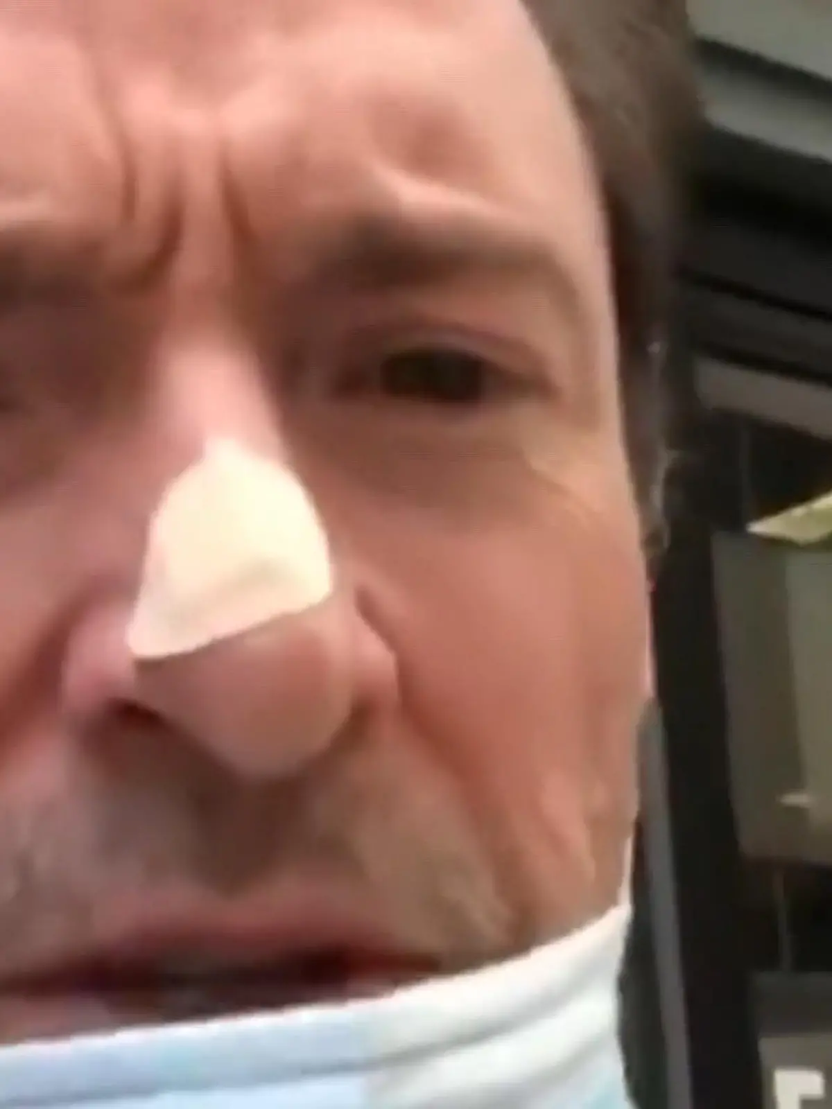 Bild zu: "Hugh Jackman: Schon wieder Hautkrebs?"
