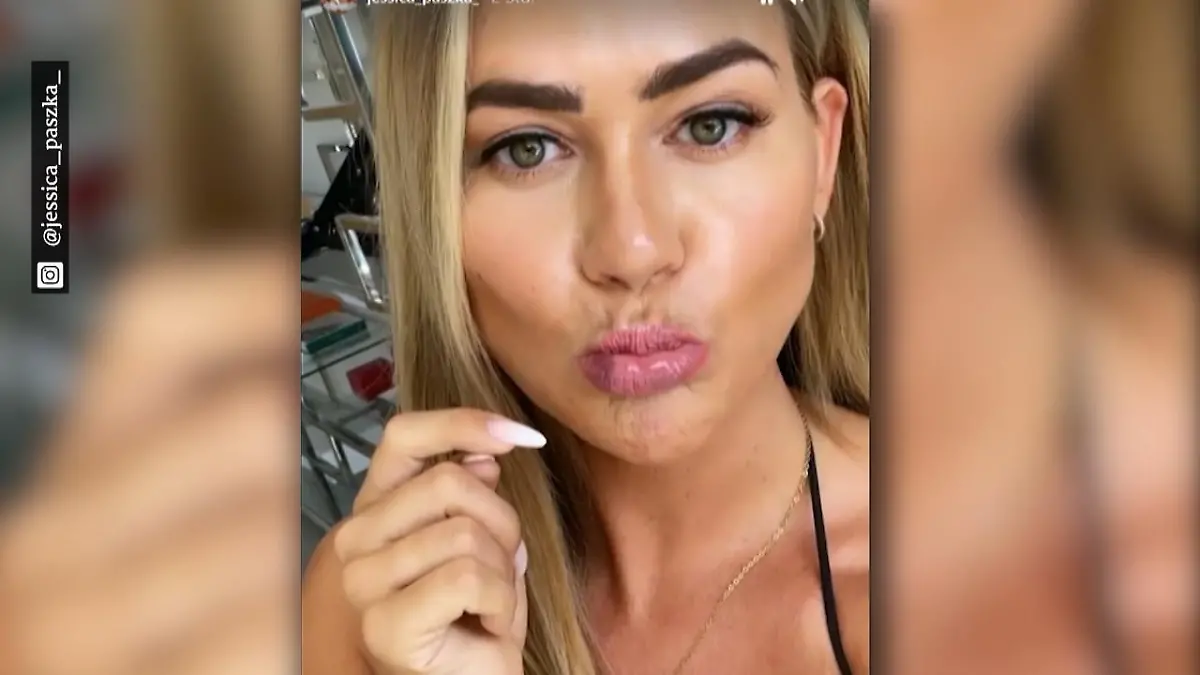 Deshalb hat Jessica Paszka blaue Lippen Beauty-Behandlung ist schuld