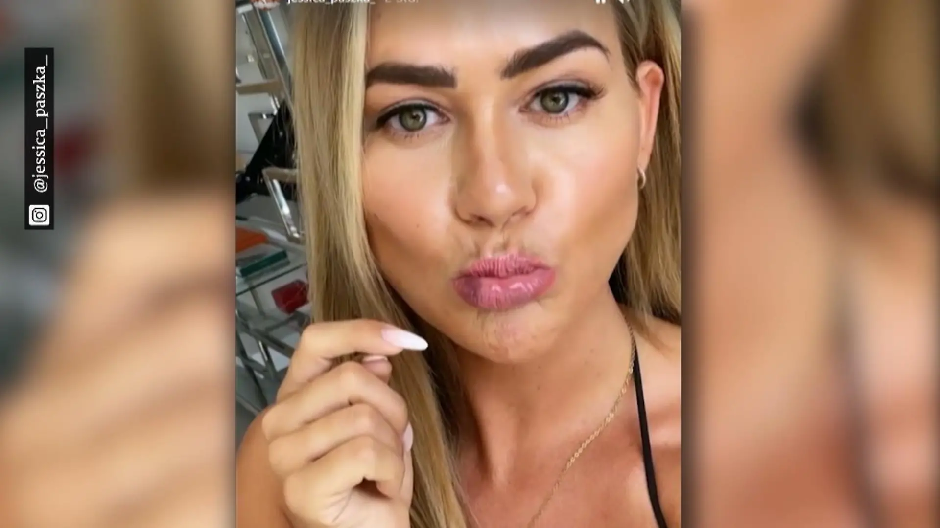 Deshalb hat Jessica Paszka blaue Lippen Beauty-Behandlung ist schuld