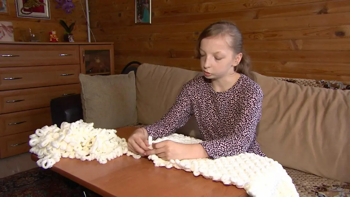 Mädchen strickt für OP zur Gesichtsangleichung Sie verkauft die Decken