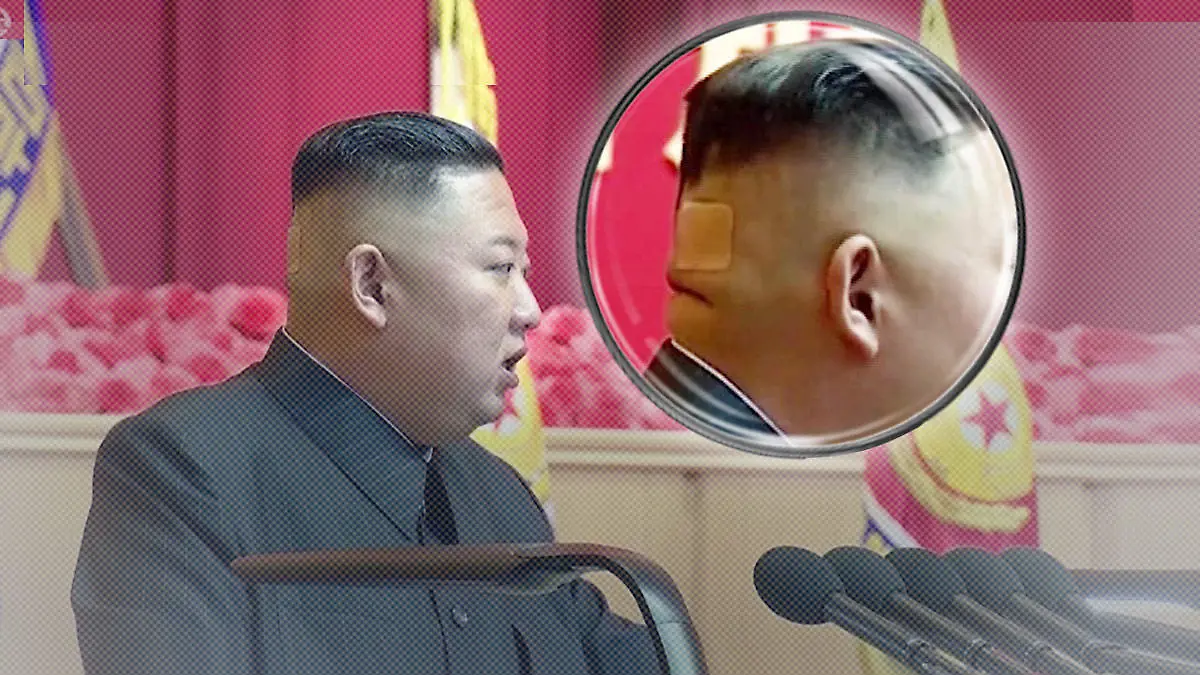 Kim Jong-Un