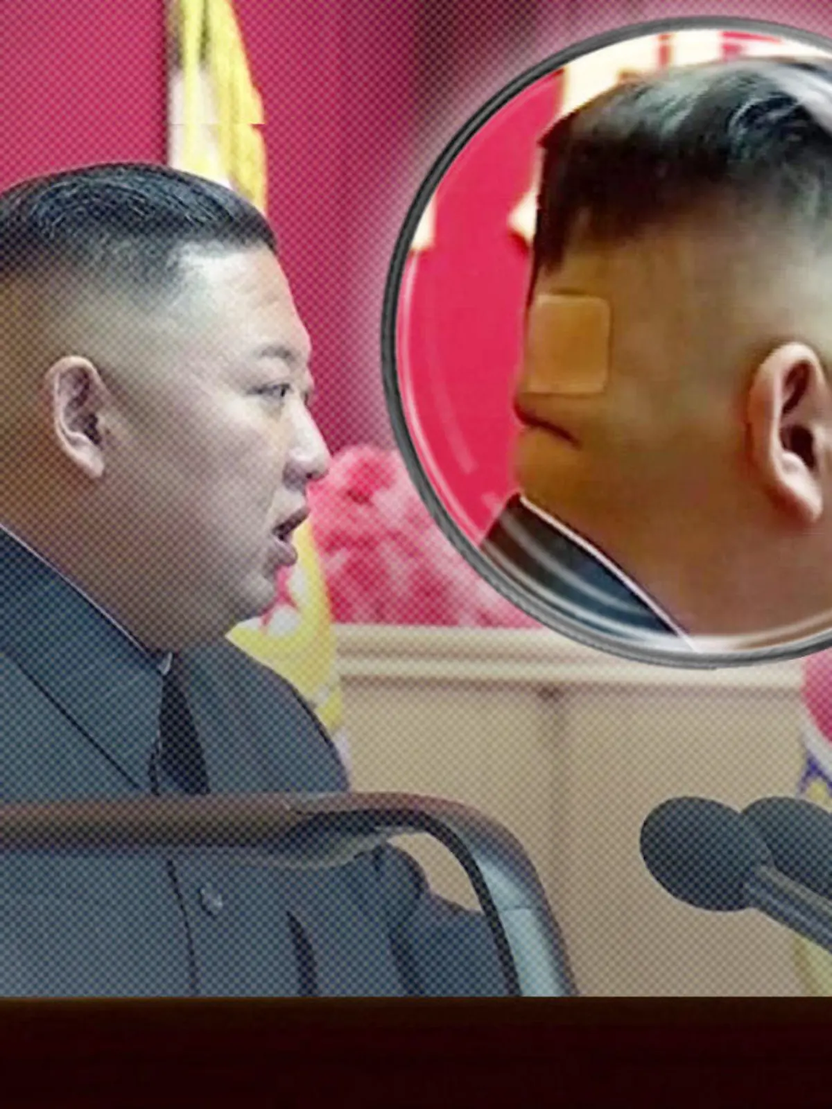 Kim Jong-Un