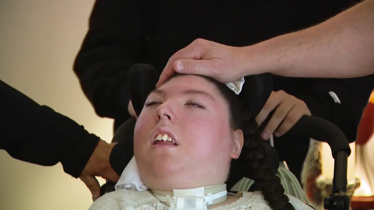 USA-Alex-20-lebt-fast-ohne-Gehirn