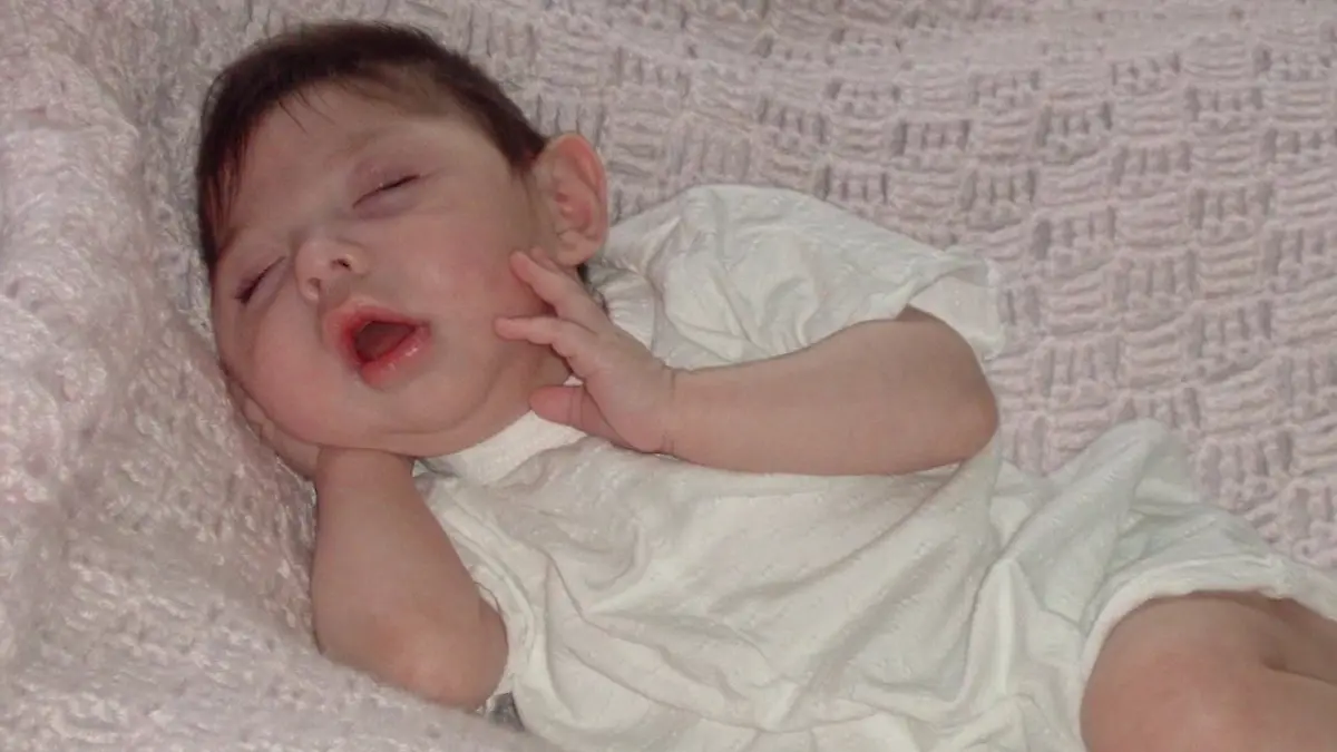 Kurz nach ihrer Geburt erhält Alex’ Familie die Schock-Diagnose.