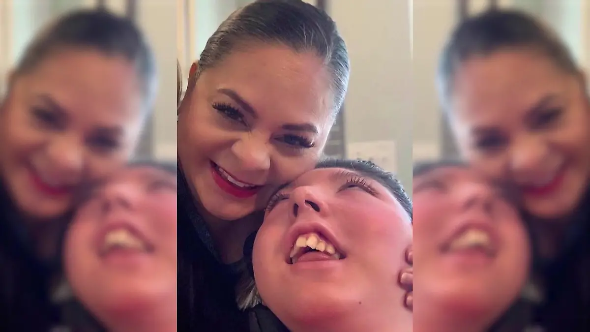 Medizinisches Wunder! Alex (20) lebt fast ohne Gehirn Jetzt feiert sie einen besonderen Meilenstein